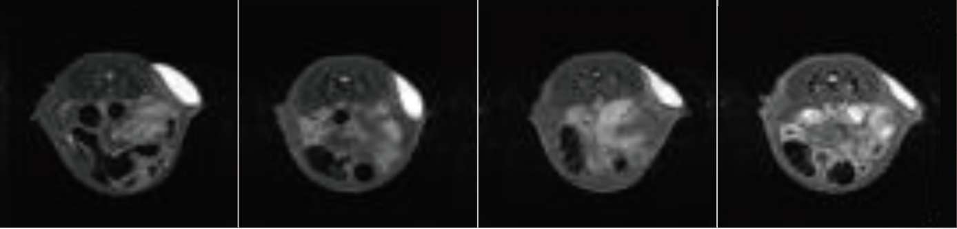 MRI: 4, 8, 16, 24 주